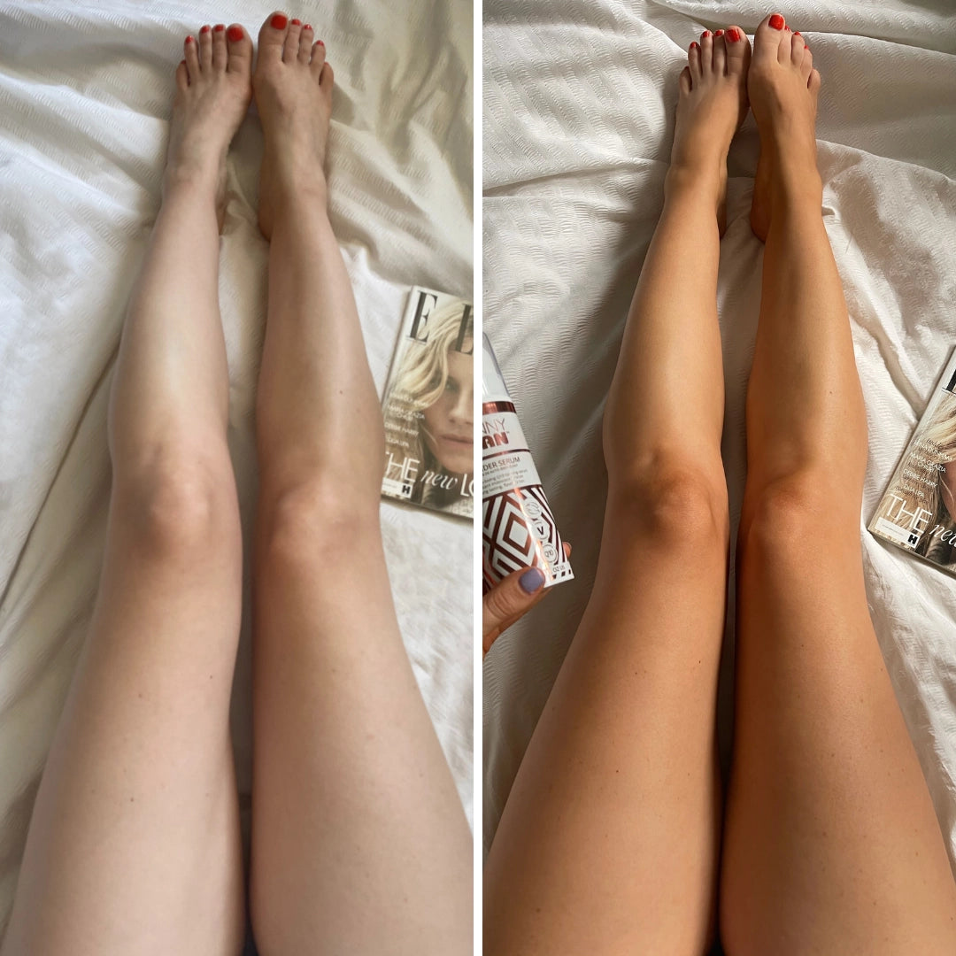 SkinnyTanWonderSerumSelfTanBeforeandAfter.webp